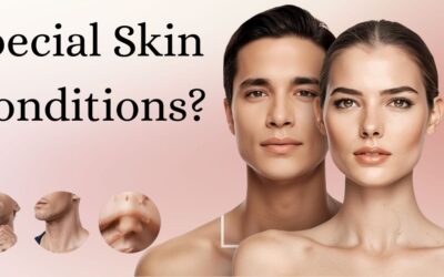 Special Skin Conditions